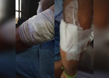 Homem é esfaqueado por criminoso durante assalto na Avenida Roque Vernalha