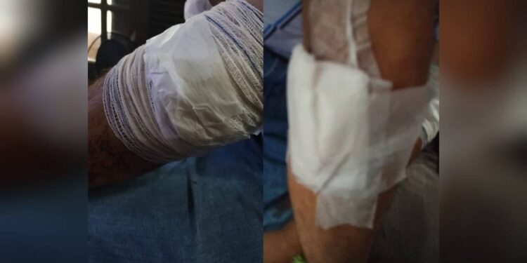 Homem é esfaqueado por criminoso durante assalto na Avenida Roque Vernalha