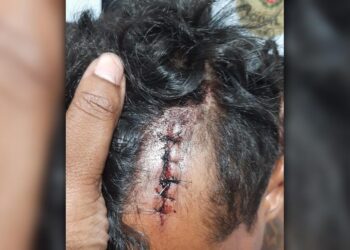 Polícia Civil prende autor de tentativa de homicídio em Morretes; indivíduo desferiu um golpe de facão na cabeça da vítima