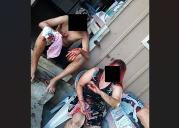 Pitbull ataca mãe e filho e deixa família aterrorizada na Vila Santa Helena, em Paranaguá