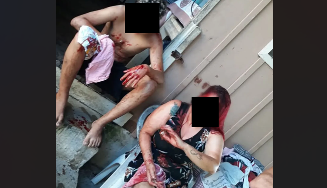 Pitbull ataca mãe e filho e deixa família aterrorizada na Vila Santa Helena, em Paranaguá