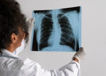 Paranaguá registra mais de 630 casos de tuberculose nos últimos anos e lidera incidência da doença no Paraná