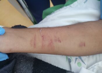 Paciente atropelado denuncia agressão dentro do Hospital Regional do Litoral