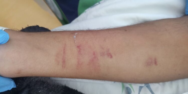 Paciente atropelado denuncia agressão dentro do Hospital Regional do Litoral