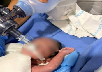 Tripulação médica do helicóptero Arcanjo 01 e guarnições do Corpo de Bombeiros atendem recém-nascido em parada cardiorrespiratória no Litoral do Estado 